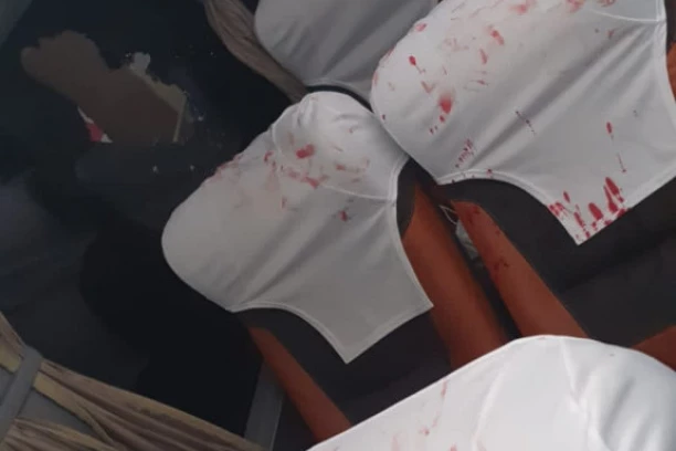 KRV ŠIKLJALA NA SVE STRANE: Eksplodirala BOMBA u autobusu sa  fudbalerima! (FOTO)