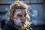 Istina o potresnom prizoru u Ukrajini: Otkriveno da li je fotografija povređene žene autentična