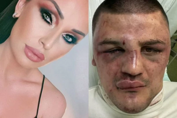 Katarina Živković PROGOVORILA o KRVNIČKOM PREBIJANJU mladića na njenom nastupu! ŠOKIRALA izjavom!