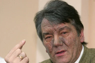 NERAZJAŠNJENA MISTERIJA: Ko je i zašto pokušao da otruje bivšeg UKRAJINSKOG predsednika Juščenka?