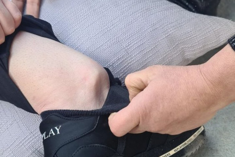 Miljana Kulić slomila nogu