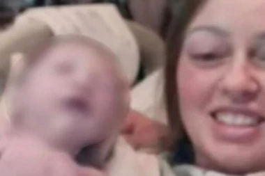 PORODILJI ISKOČILO OKO TOKOM POROĐAJA: Doktori ostali u šoku! Ovo nikad do sada nismo videli