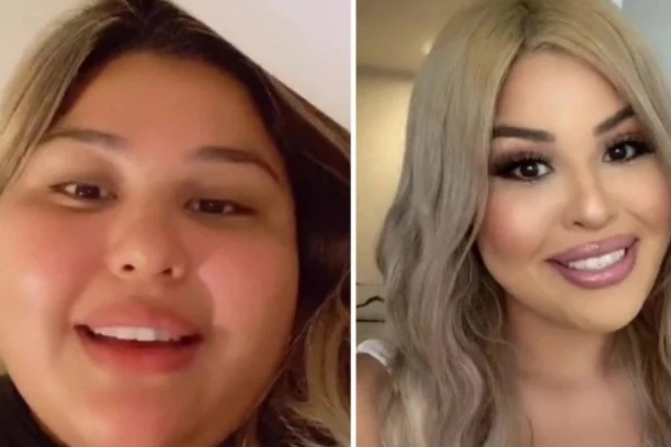 UZ SVE DIJETE NISAM MOGLA DA SMRŠAM! A onda su lekari iz mene izvadili nešto što me je uništavalo!