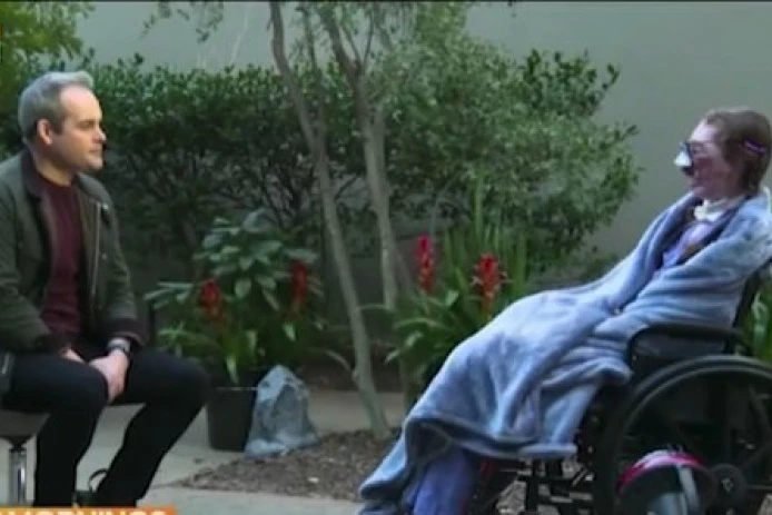 PSI JE IZGRIZLI 800 PUTA, KOŽA JOJ JE VISILA SA TELA! Devojka unakažena za ceo život, dve životinje koje je čuvala napale su je odmah s vrata! (UZNEMIRUJUĆI VIDEO)