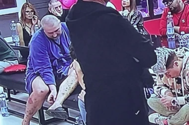 Mikijeva bolest napreduje: Zadrugar se sav OSIPA, psorijaza uzela maha, pčelar ima RANE po CELOM TELU - češe se zbog NESNOSNOG SVRABA! (FOTO)