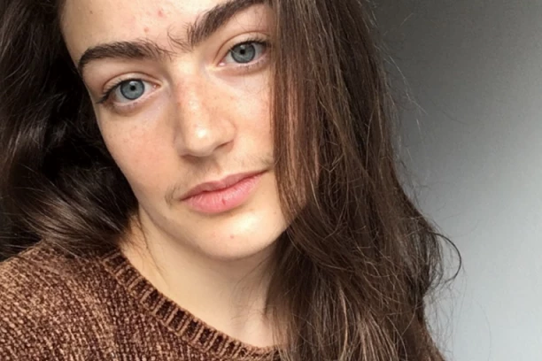 ELDINA JE BOSANSKA LEPOTICA KOJA JE PRESTALA DA SE DEPILIRA! "Ljudi su mi prilazili i govorili da je to KUL!"