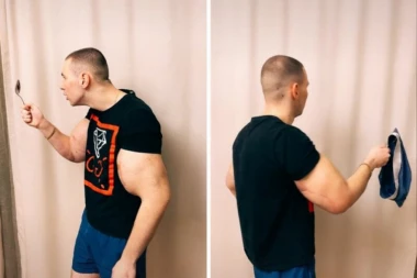 OPREZ! Poznati influenser UBRIZGAO VAZELIN U BICEPSE, doktori prestravljeni zbog AMPUTACIJE ruke ILI SMRTI! (VIDEO)