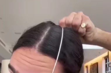 KONAC ZA ZUBE SADA IMA GENIJALNU NOVU PRIMENU! Rezultat je zapanjujuć!