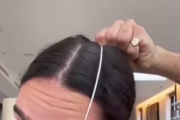 KONAC ZA ZUBE SADA IMA GENIJALNU NOVU PRIMENU! Rezultat je zapanjujuć!