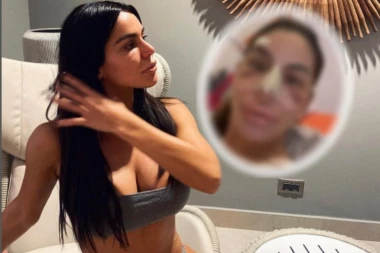 Naša pevačica završila na OPERACIJI, pojavila se fotka iz bolničkog kreveta: Masnice i podlivi svuda po licu, usne joj NABREKLE samo što ne puknu! (FOTO)