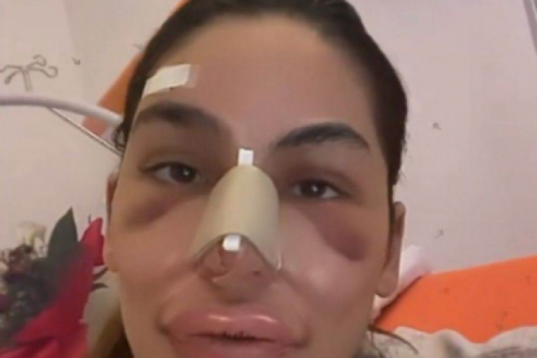 Marina Visković operacije