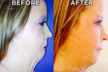 MUŽ JE LUPIO ČEKIĆEM, ISPOLIVAO BENZINOM I ZAPALIO: Prošla kroz pakao, a ovako izgleda sedam godina kasnije (VIDEO)