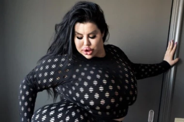 SRPKINJA IMA NAJVEĆU ZADNJICU NA SVETU! Operacije je platila vise od 100.000 evra,  a novom kombinacijom je šokirala! (FOTO, VIDEO)