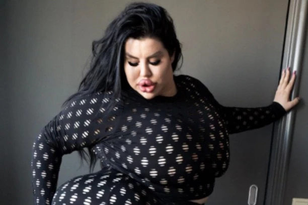 SRPKINJA IMA NAJVEĆU ZADNJICU NA SVETU! Operacije je platila vise od 100.000 evra,  a novom kombinacijom je šokirala! (FOTO, VIDEO)