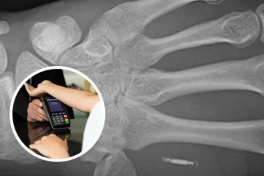 BUDUĆNOST PLAĆANJA: Ugrađeni mikročip koji omogućava naplatu RUKOM!