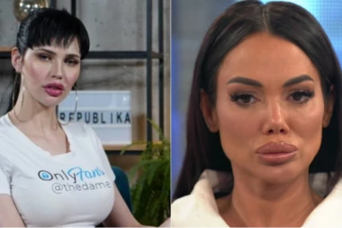 Deniz Dejm SPAVALA sa PLASTIČNIM HIRURGOM Tamare Đurić! Umesto 10.000 EVRA, završila u njegovom KREVETU!