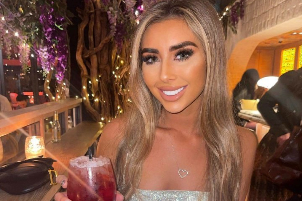 Saskija Vard i njeni beli zubi 