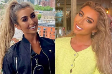 INFLUENSERKA POZIVA LJUDE DA IZBELJUJU ZUBE ŠAMPONOM! Skandal, odmah reagovali stručnjaci: Od toga može da se umre! (FOTO)