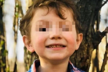 DEČAK (8) ZAPALIO DRUGARA (6), BIĆE VAM MUKA OD PRIZORA, DETE VRIŠTALO: "Mama, zapalili su me! (FOTO)