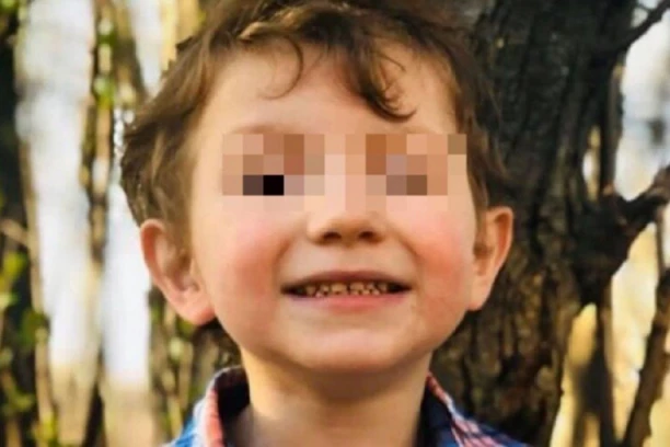 DEČAK (8) ZAPALIO DRUGARA (6), BIĆE VAM MUKA OD PRIZORA, DETE VRIŠTALO: "Mama, zapalili su me! (FOTO)