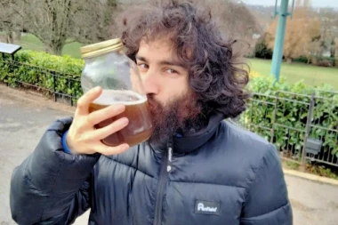 SVAKI DAN PIJEM SVOJ URIN I EFEKTI SU NEZAMISLIVI! Priča koja izaziva gađenje, naterala i lekare da reaguju