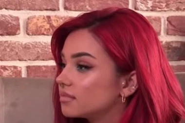 BRESKVICA BEZ ŠMINKE FRAPIRALA JAVNOST: Naišla na ŽESTOKE PROZIVKE, svi gledaju u NEVERICI! (FOTO)