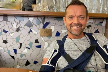 ČUDO! ŽIVIM KAO U BAJCI: Ispovest prvog čoveka na svetu kojem je urađena TRANSPLATACIJA obe ruke! (FOTO)