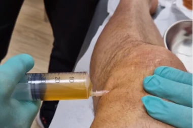 IBRIN PAKAO: Zlatan objavio kako su mu špricem izvlačili GNOJ iz KOLENA! (VIDEO)