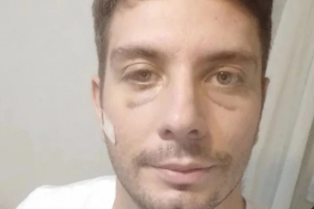 Stefan Mihić završio na REANIMACIJI! Bivši zadrugar HITNO operisan, jedva PREŽIVEO! (FOTO)