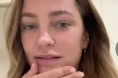 Želela sam novu bradu, a ono što su mi uradili pretvorilo mi je život u pakao! SADA IMAM ĆUREĆI VRAT! (VIDEO)