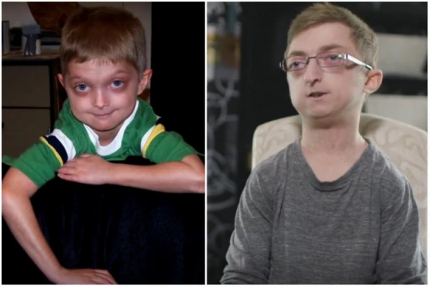 DANAS DEČAK, SUTRA DEDA! Jedini na svetu ima ovu bolest: Stari pet put brže od bilo koga! (VIDEO)