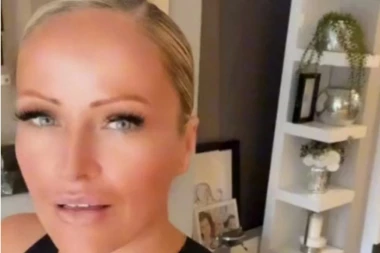 NIJE KORISTILA KREMU ZA SUNČANJE, A SADA JE POKAZALA POSLEDICE! Kada joj vidite glavu šokiraćete se, a tek LICE (FOTO)