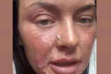 Unakazila se zbog BIZARNOG KUHINJSKOG TRENDA KOJI KRUŽI TIKTOKOM! Popularna društvena mreža zaludela i domaćice, evo šta je ona htela da napravi!