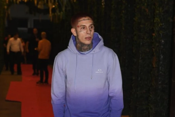 PROLIVENA KRV PO TELU! Fran Pujas napravio HAOS novom objavom, evo šta kaže nakon POMETNJE! (FOTO)