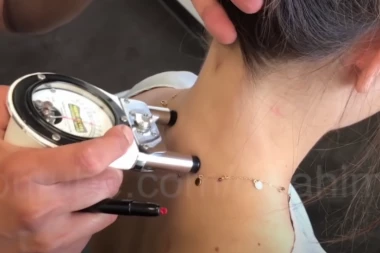 MILAN NIJE JEDINI SLUČAJ! Kiropraktičar devojci (28) potpuno uništio život! Ostala skroz PARALIZOVANA!