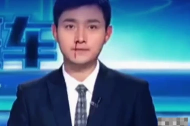 UŽAS U PROGRAMU UŽIVO! Voditelju teče krv iz nosa i sliva se u usta! Njegova reakcija izazvala je buru na društvenim mrežama! (VIDEO)