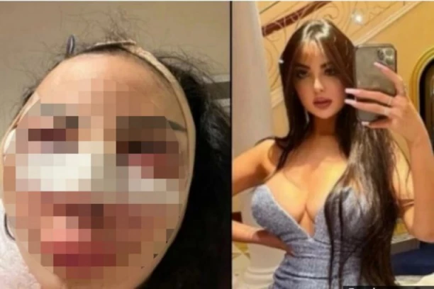 HTELA JE DA LIČI NA KIM KARDAŠIJAN PA SE POKAJALA: Ljudi beže od mene na ulici, a bila je VERSAĆEOV MODEL (FOTO)