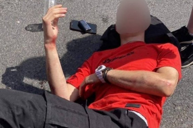Pokušao da uhvati lopova pa ga pokosio automobil: Mladić iz Beograda zadobio prelom karlice i leve ruke