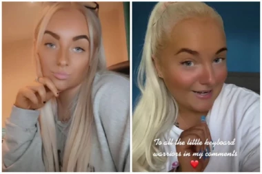 SA 18 MESECI SAM DOBILA MENSTRUACIJU, a sa sedam godina sam imala grudi kao devojka! Šokantna ispovest o izuzetno retkom poremećaju!