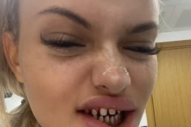 Ispunili su mi želju da KONAČNO DOBIJEM SVOJ TURSKI OSMEH! Ova devojka zaprepastila je svet! (FOTO)