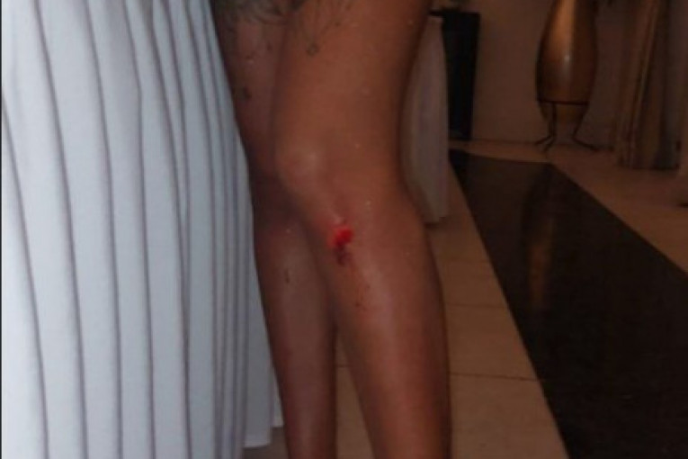 Tijana Ajfon se povredila