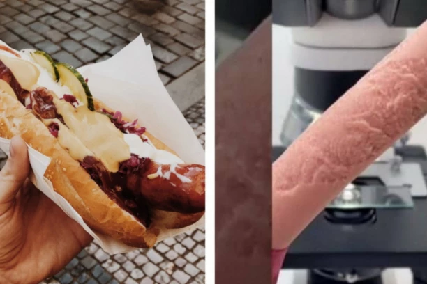 Objavljen šokantan snimak mikroskopskog prikaza viršli! Zbog onog što je zabeleženo zapitaćete se dvaput da li ćete ih ponovo jesti!