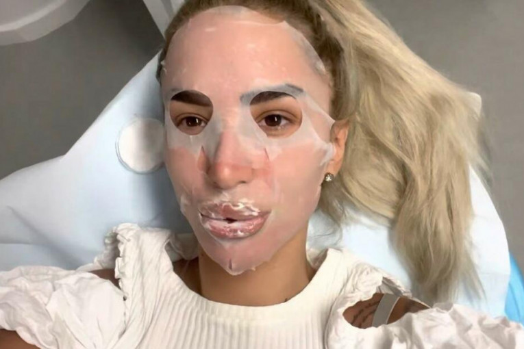 Aleksandra Nikolić izvadila silikone iz usana