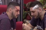 "Znao sam da sam ŽIV, ali da nije dobro" Zola otkrio JEZIVE momente iz Zadruge, nakon što mu je Miljana ŠTIKLOM PROBILA glavu, ovo mu se motalo po mislima! (FOTO)