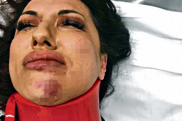 "Kad te udari, da ideš četiri kilometra u rikverc" Nakon JEZIVIH BATINA koje je dobila Marina Radosavljević, pevačeva poruka će vas NAJEŽITI! (FOTO)