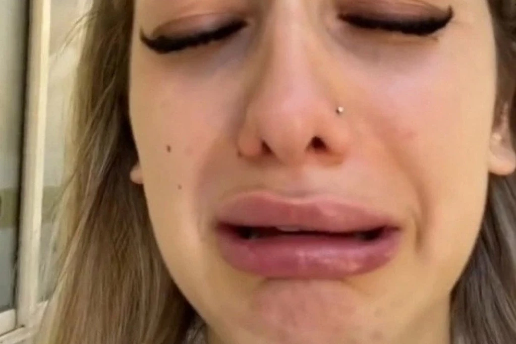 OČAJ ZBOG FILERA U USNAMA! Devojka podelila sa čitavim svetom kako izgleda nakon intervencije: Patka mi nije ravna!