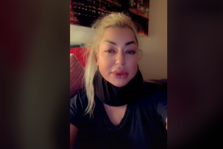 Sandra Rešić sva u PODLIVIMA, OTEČENOG LICA i sa polomljenom NOGOM! Pevačica otkrila kako se oseća nakon SAOBRAĆAJKE! (FOTO, VIDEO)