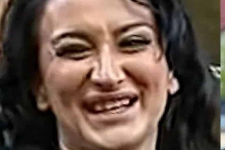 Andreana Čekić pre korekcija