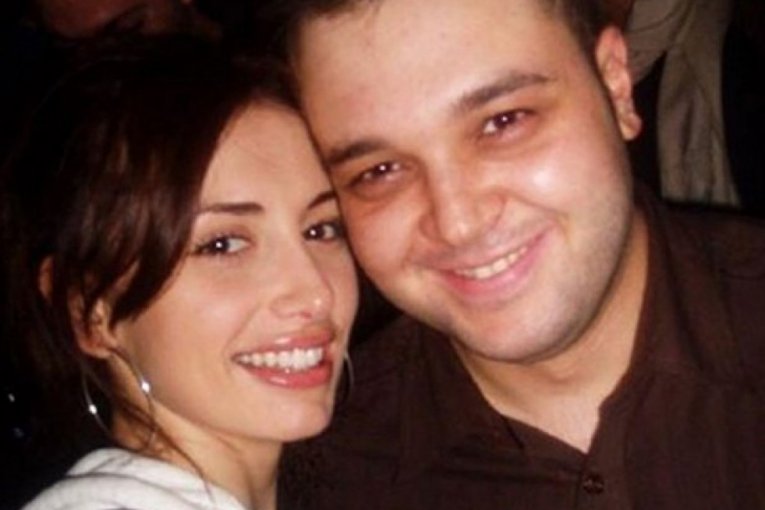 Emina Jovanović pre operacije zuba