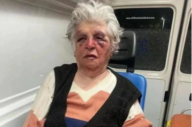 DETALJI BRUTALNOG NAPADA NA BAKU BOŽANU U SEVERNOJ MITROVICI: Napadači su govorili ALBANSKI